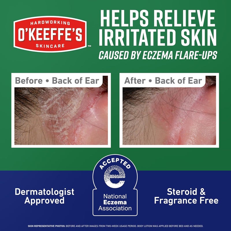 OKeeffes O’Keeffe’s Skin Repair Eczema Relief Body Cream, 7oz Tube (Pack of 1) – 48 Hour Itch Relief in One Use - Image 3